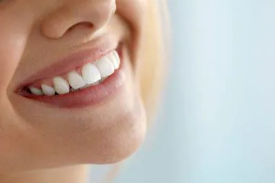 Close-up of a woman's bright white smile